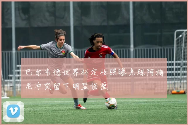巴尔韦德世界杯定妆照曝光琼阿梅尼冲突留下明显伤痕